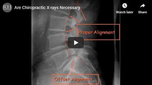 Chiropractic Inver Grove Heights MN Blog - X Rays